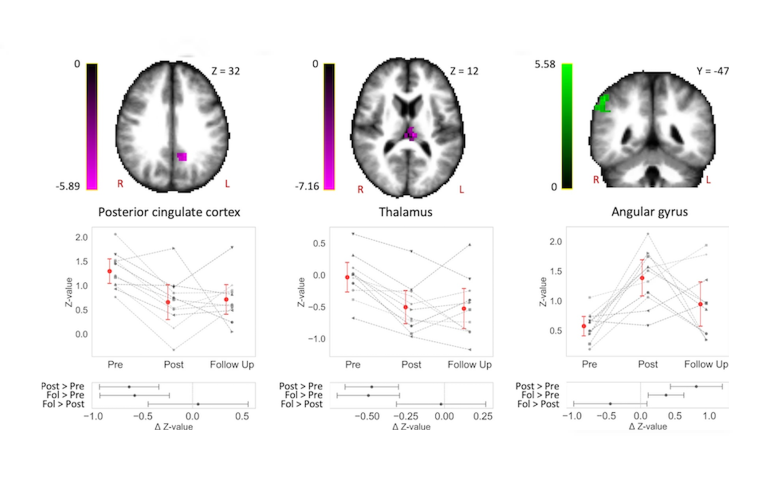 How Space Travel Influences The Way A Human Brain Works